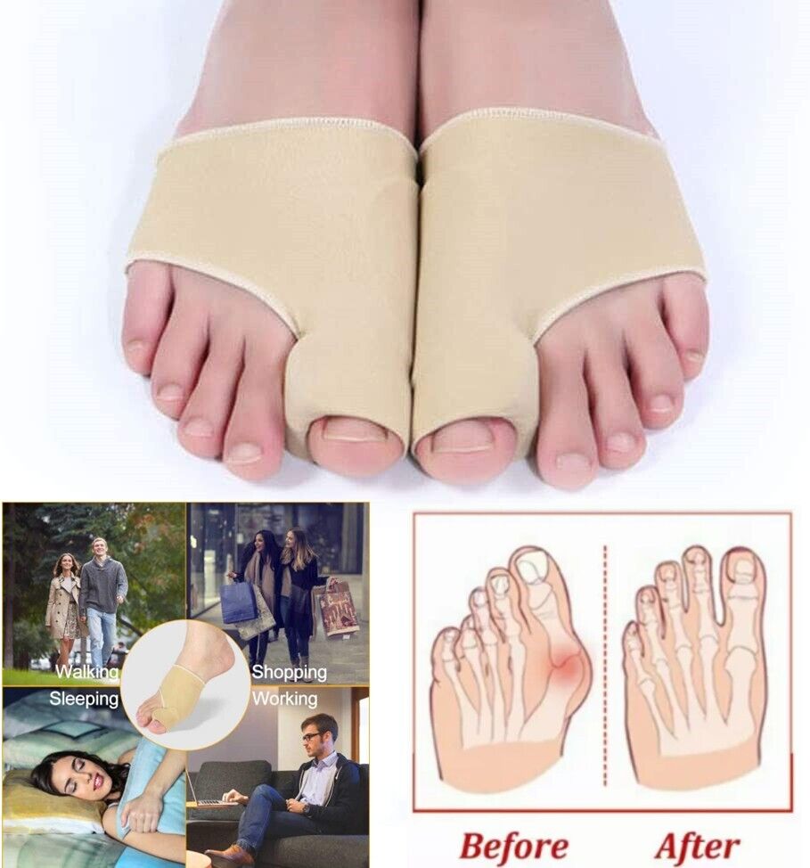 Adjustable Bunion Corrector Toe Splint – Big Toe Straightener for Pain Relief, Foot Alignment & Hallux Valgus Support (Comfortable Orthopedic Design)